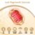 Hair Growth Device Low Level Laser Therapy (LLLT) Device 650-660nm Laser; Red Light Therapy for Hair Growth FDA Cleared for Androgenetic Alopecia; SGS Clinically Tested, Rechargeable Battery LS-D30